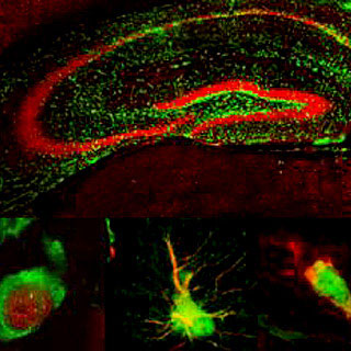 neural stem cell