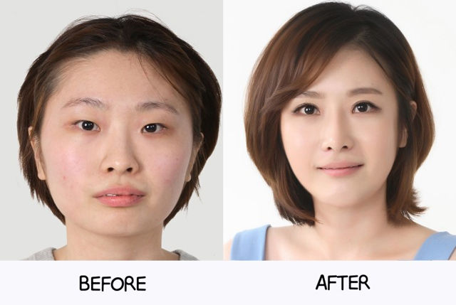 before_and_after_photos_of_korean_plastic_surgery_part_2_640_61